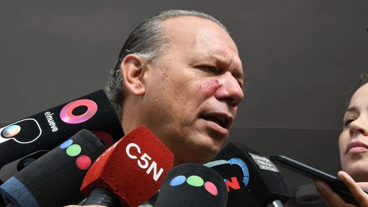 Berni denunció la participación de “agitadores del PRO” en la golpiza que recibió